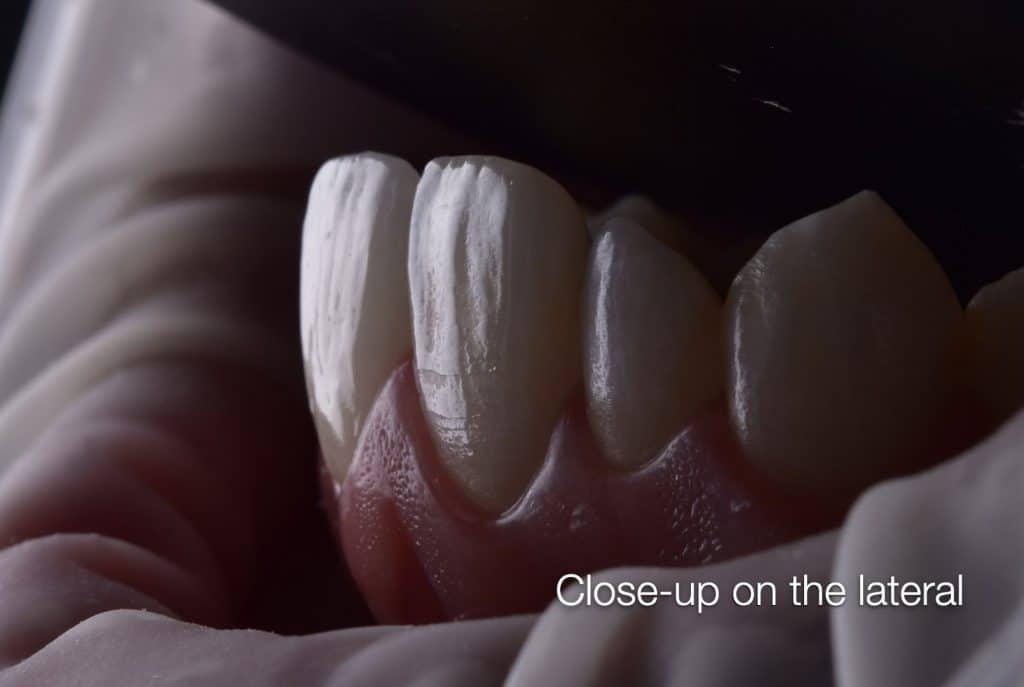 zhouyu_Ding _CASE_02.021