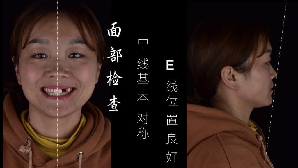 美学区的种植病例比赛.004