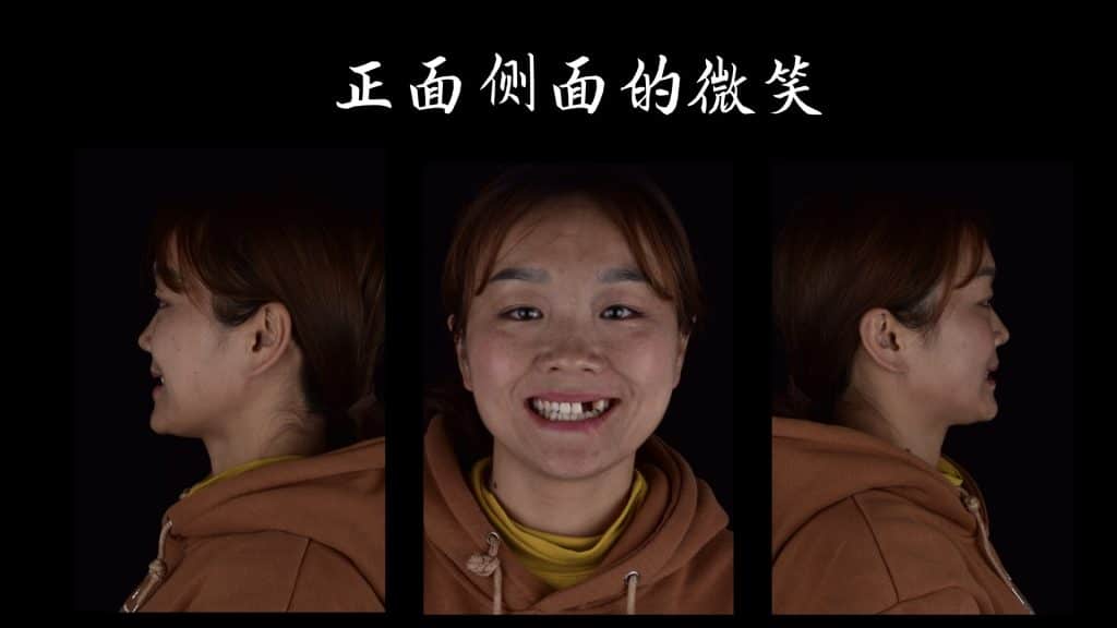 美学区的种植病例比赛.005