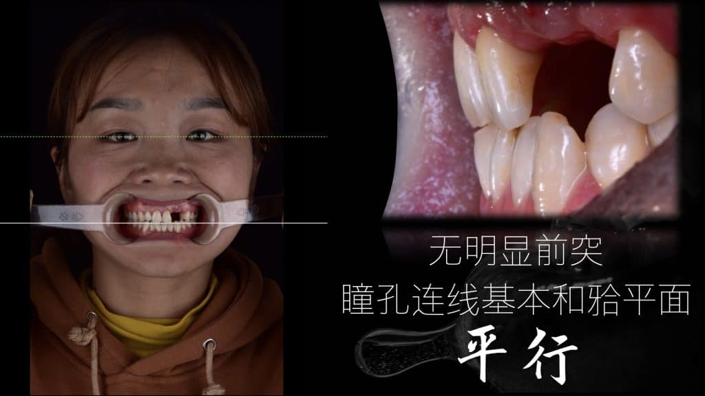 美学区的种植病例比赛.006