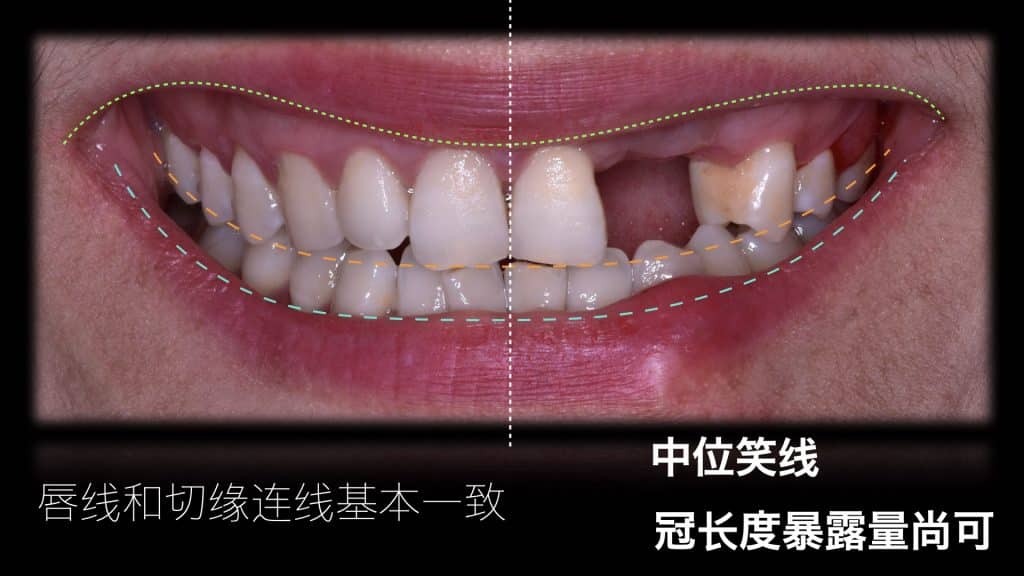 美学区的种植病例比赛.007