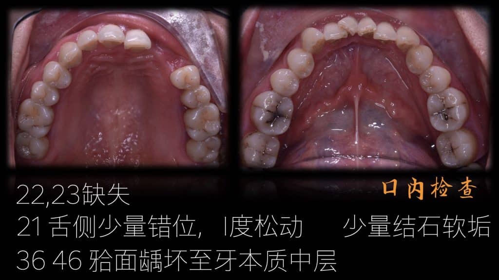 美学区的种植病例比赛.009
