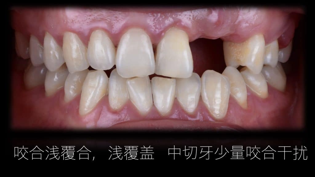 美学区的种植病例比赛.010