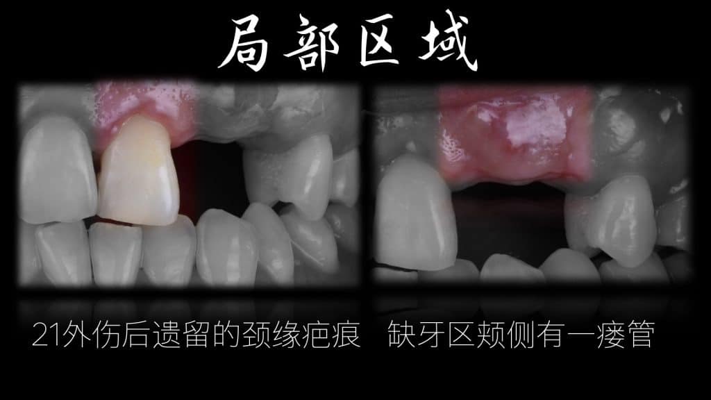 美学区的种植病例比赛.011