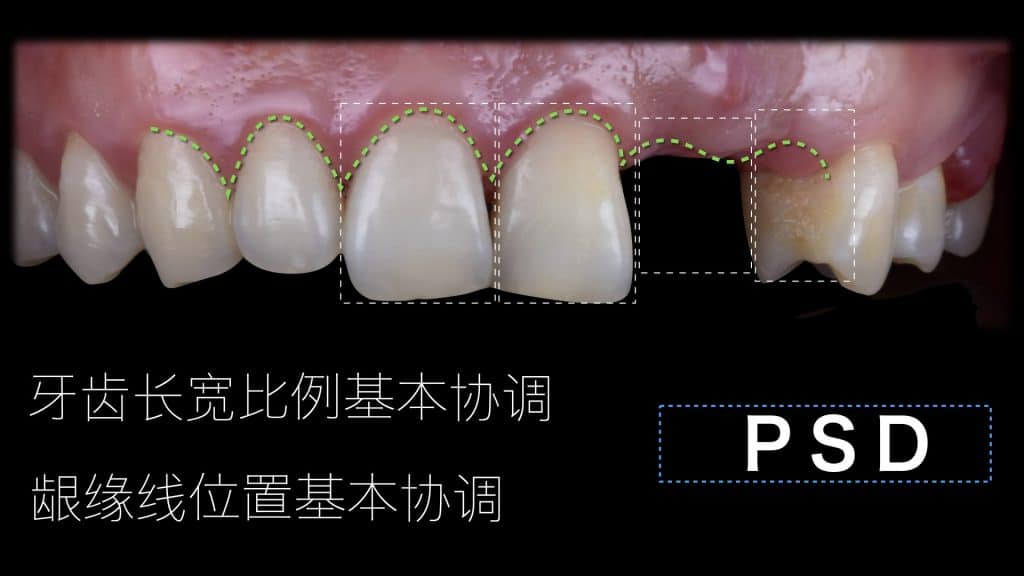 美学区的种植病例比赛.012