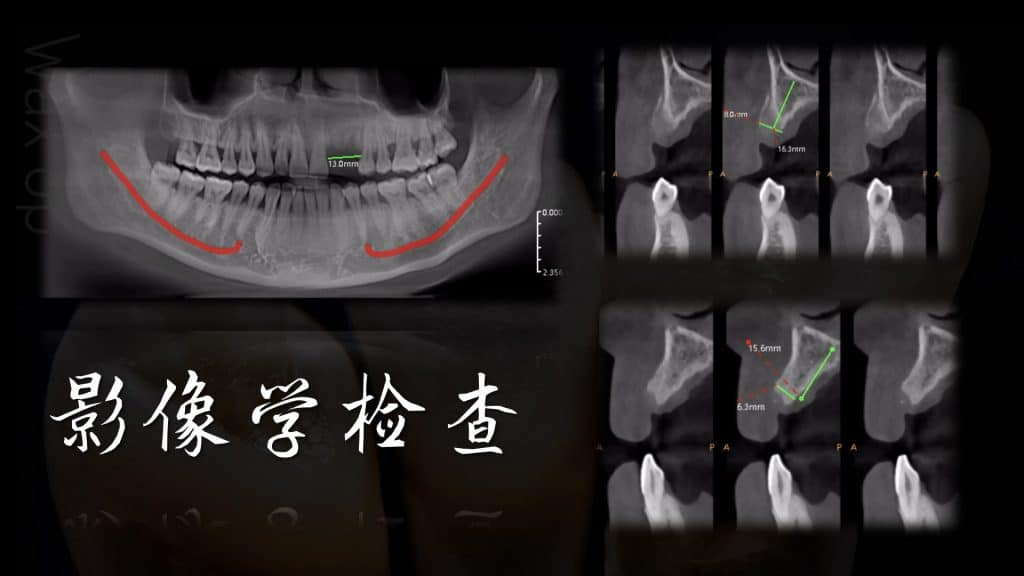美学区的种植病例比赛.013