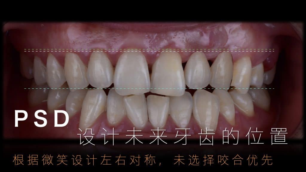 美学区的种植病例比赛.019