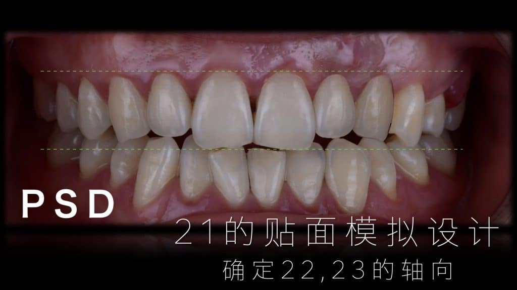 美学区的种植病例比赛.020