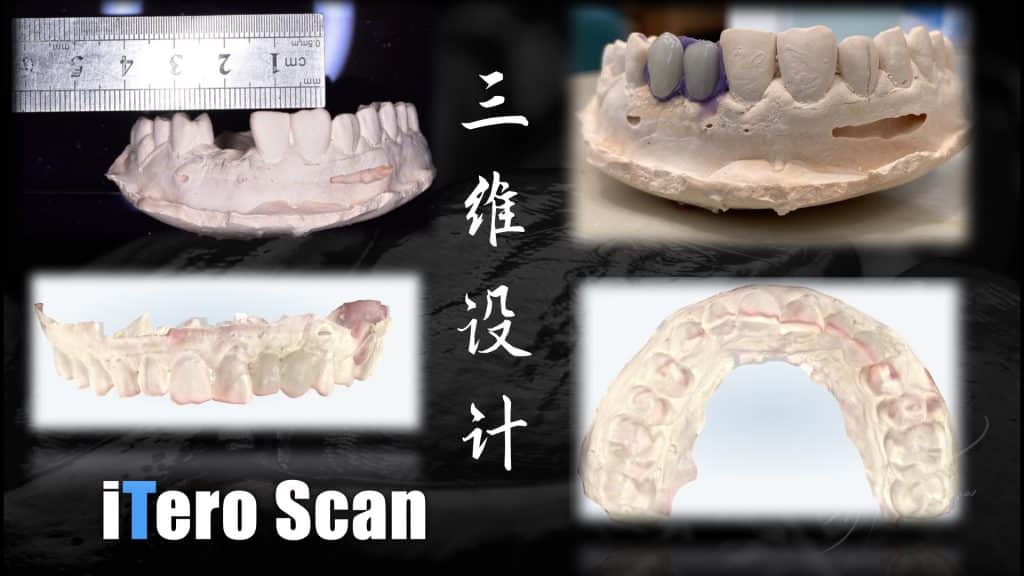 美学区的种植病例比赛.022