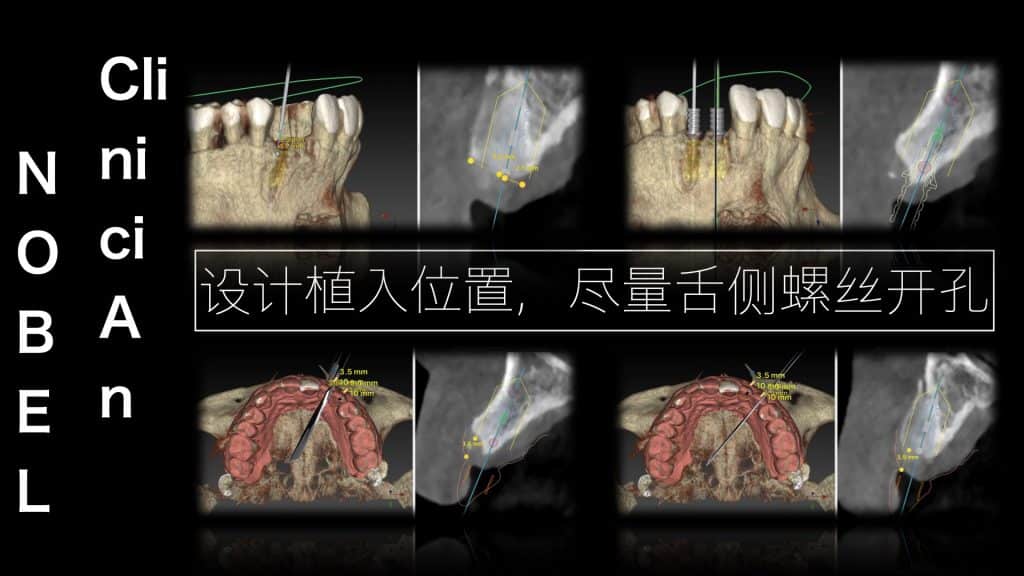 美学区的种植病例比赛.023