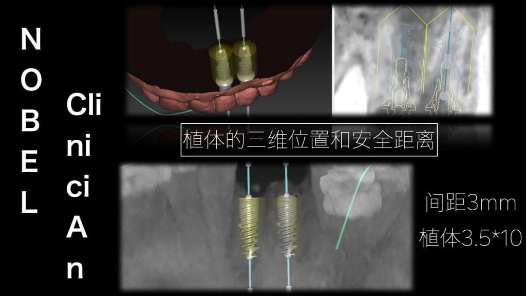 美学区的种植病例比赛.024