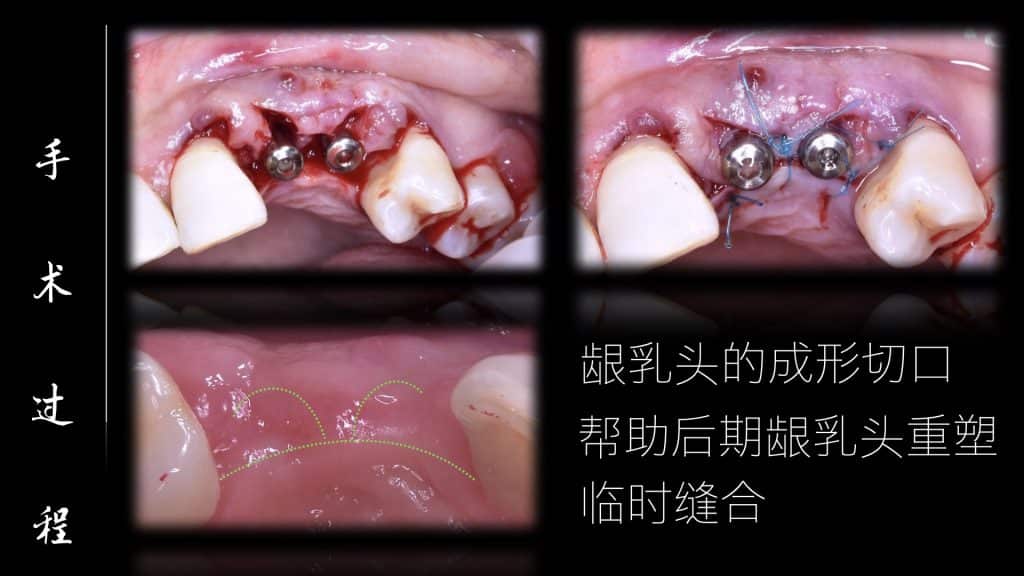 美学区的种植病例比赛.030