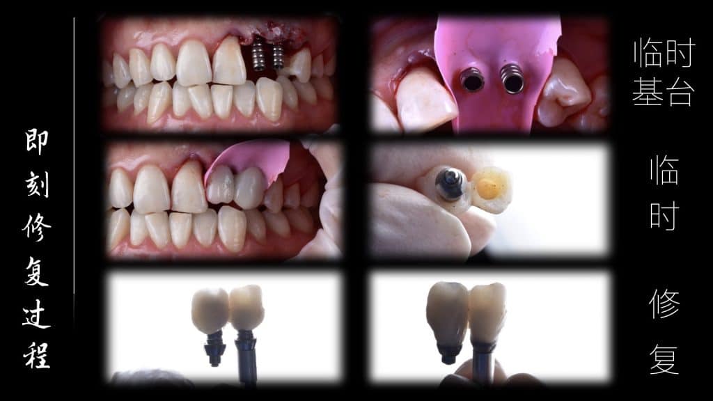 美学区的种植病例比赛.031