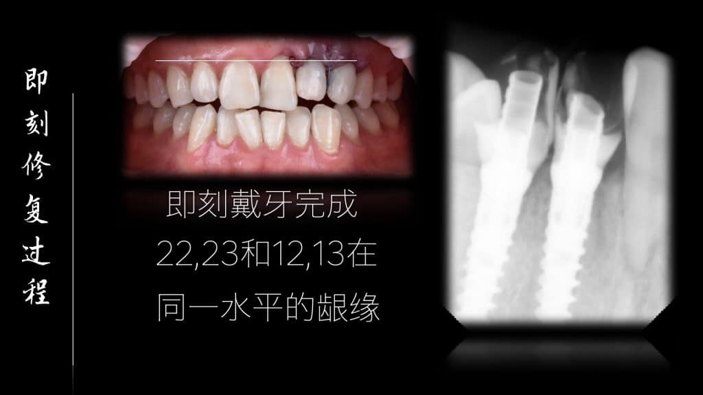 美学区的种植病例比赛.032