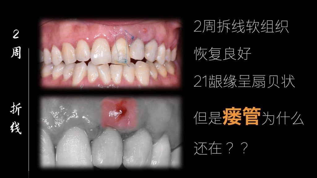 美学区的种植病例比赛.034