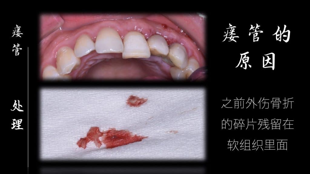 美学区的种植病例比赛.035