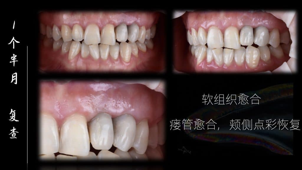 美学区的种植病例比赛.036