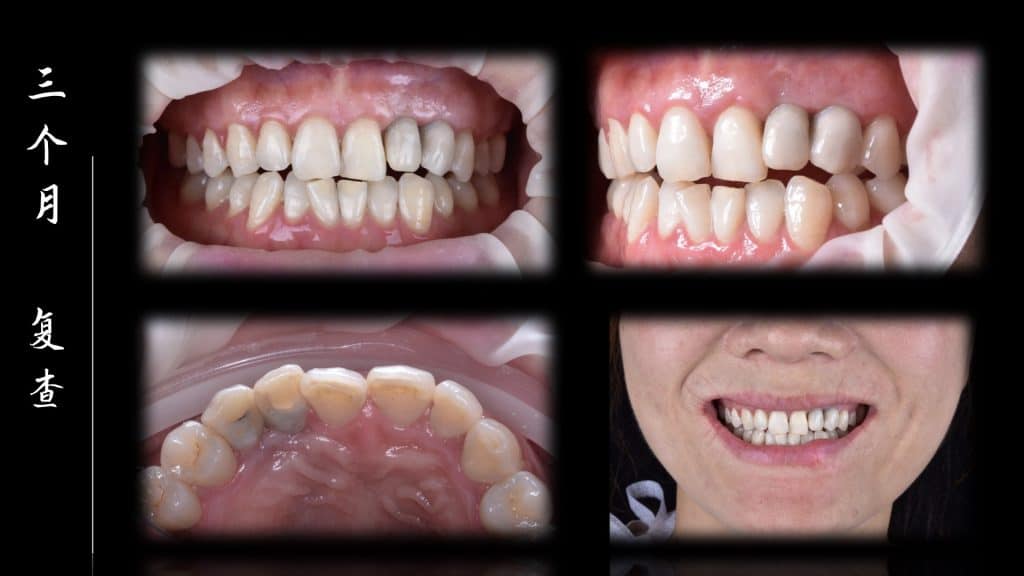 美学区的种植病例比赛.037