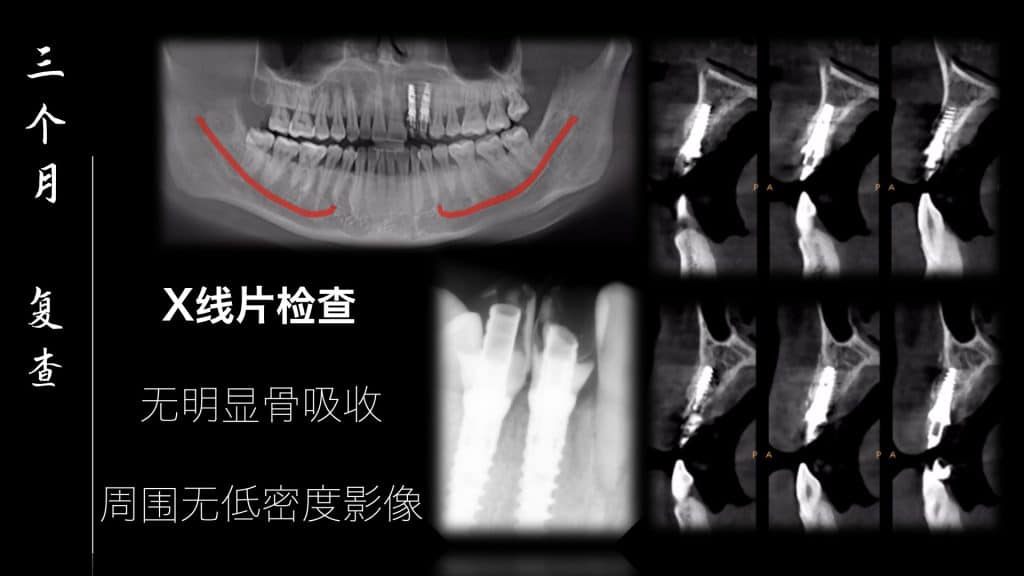 美学区的种植病例比赛.039