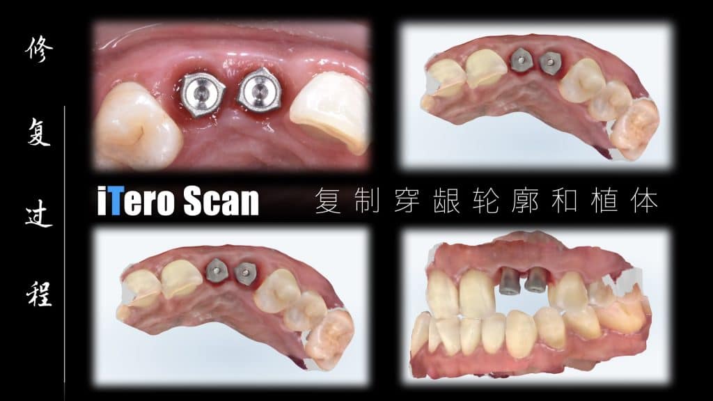 美学区的种植病例比赛.042