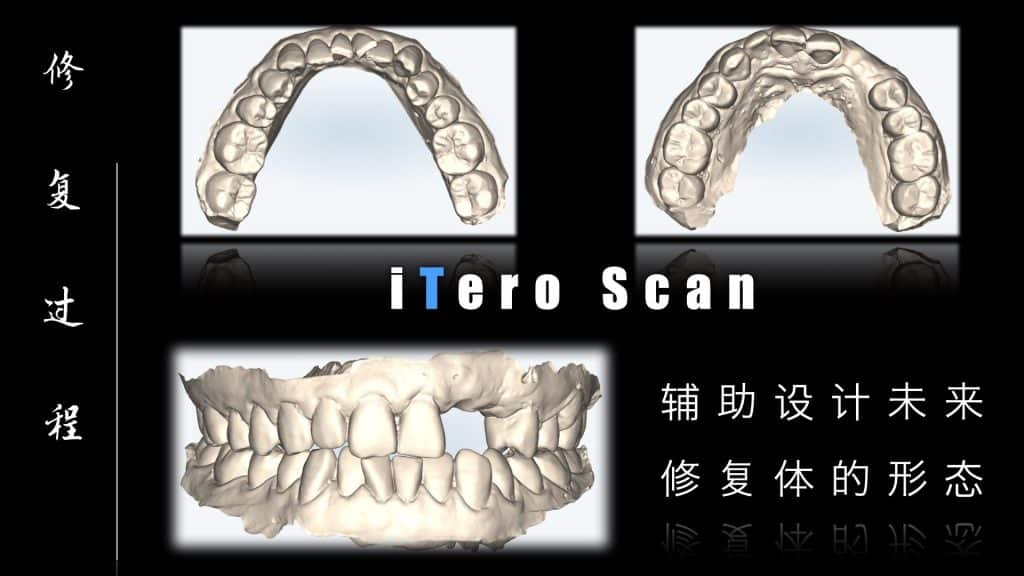 美学区的种植病例比赛.043