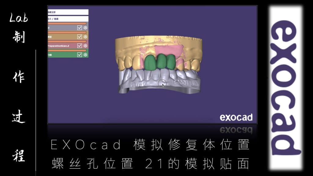 美学区的种植病例比赛.044
