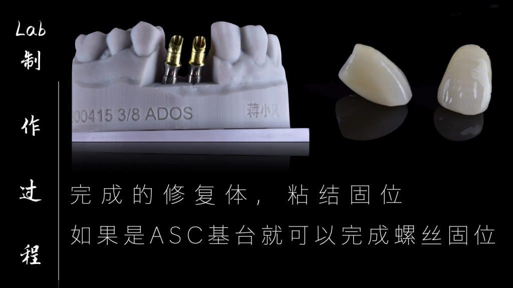 美学区的种植病例比赛.045