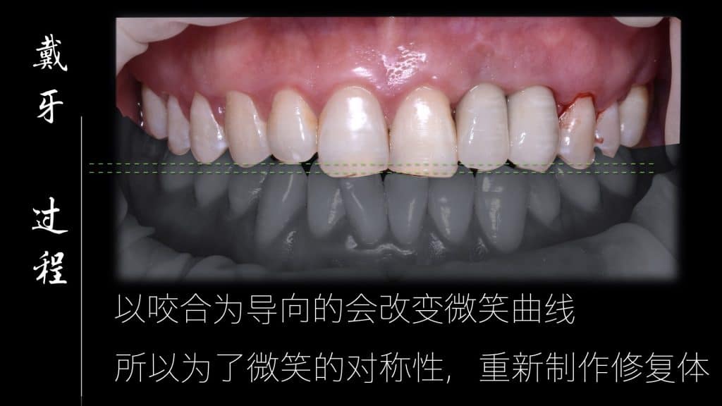 美学区的种植病例比赛.048
