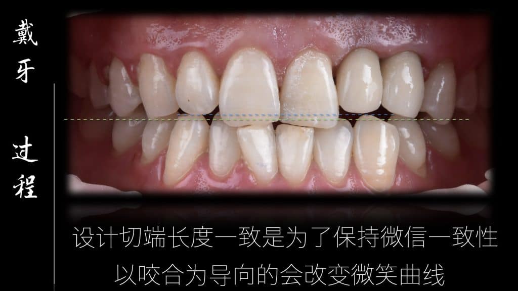 美学区的种植病例比赛.049