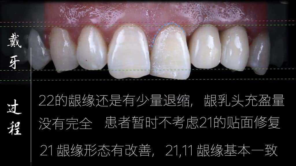 美学区的种植病例比赛.050