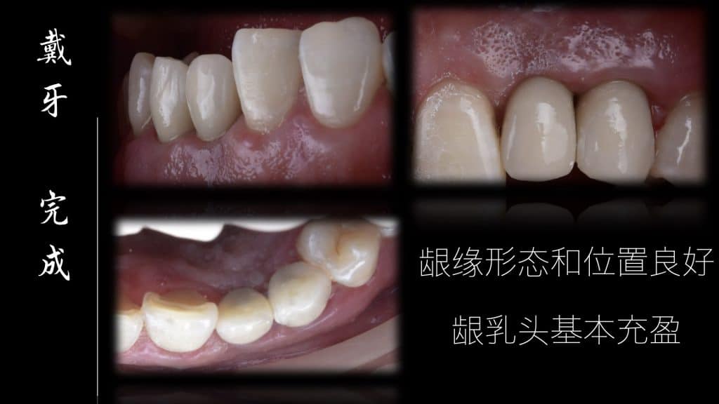 美学区的种植病例比赛.052