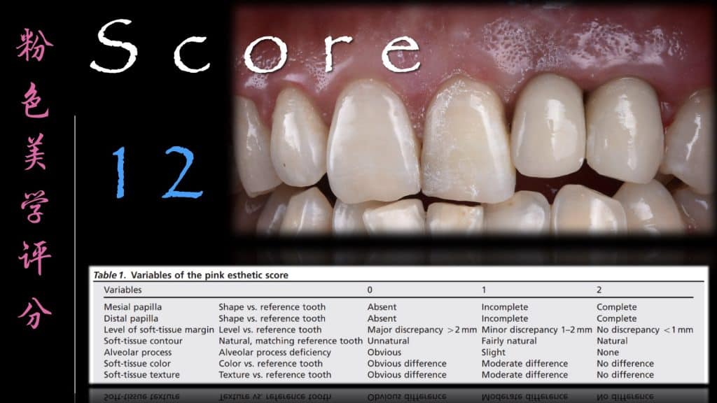 美学区的种植病例比赛.053
