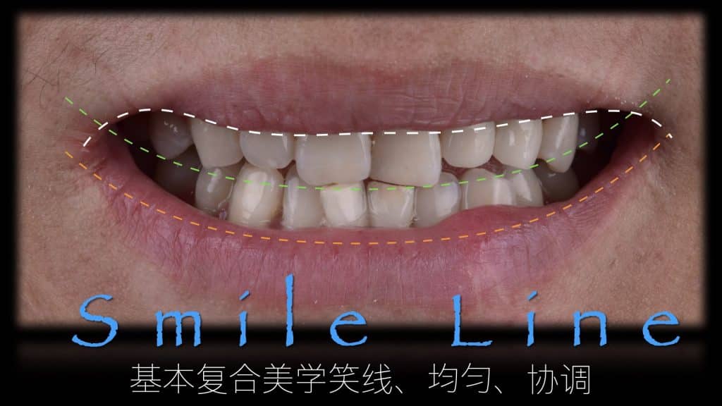 美学区的种植病例比赛.054