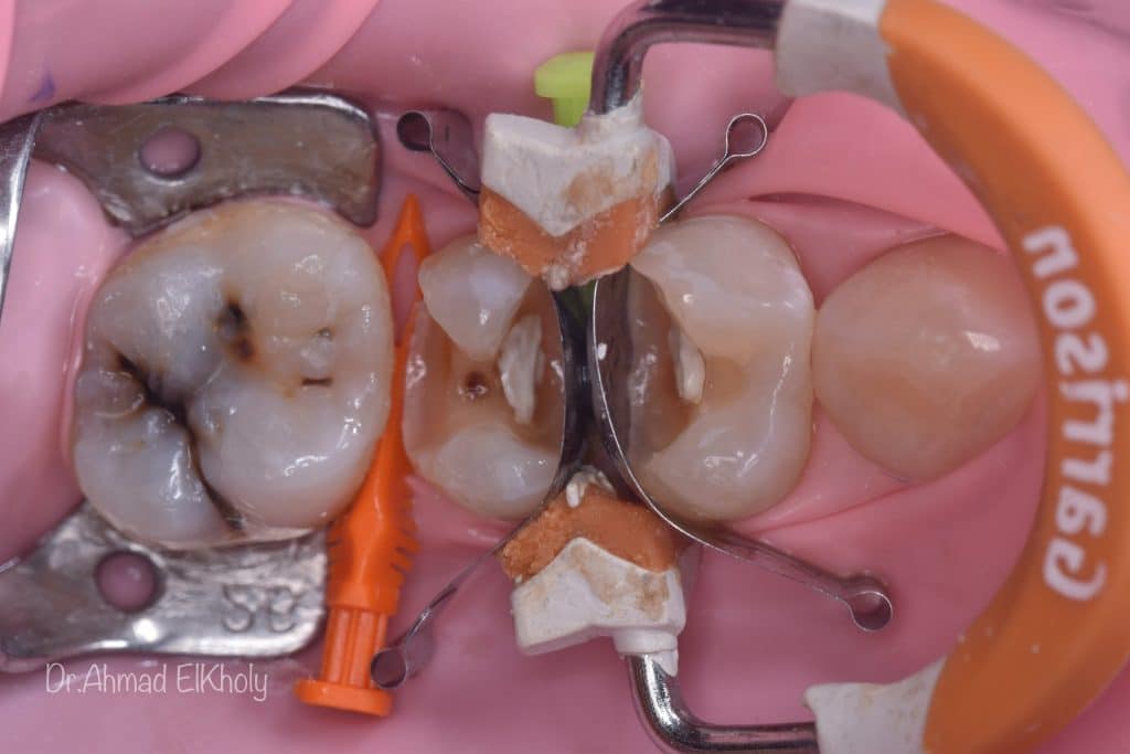 01D01F0A-8A1E-4E1A-B31F-BA7E04B27FC8