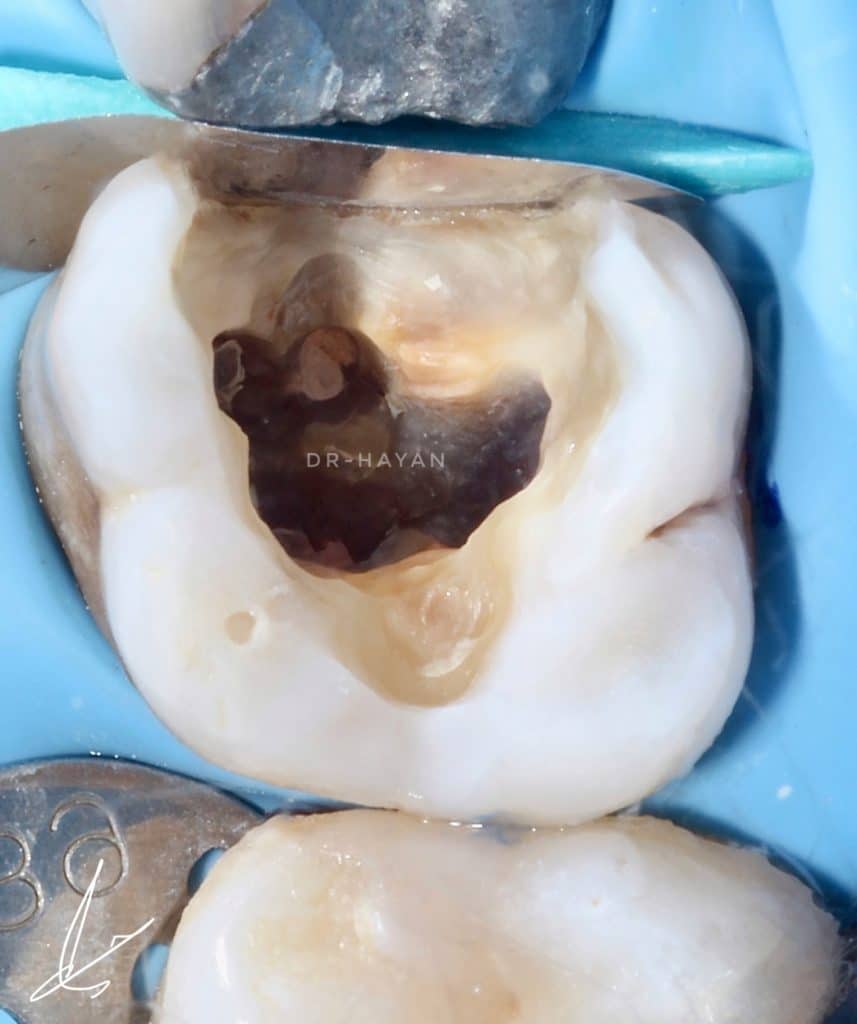 0F662A67-CDFE-4EF5-B998-93E8E66D7191