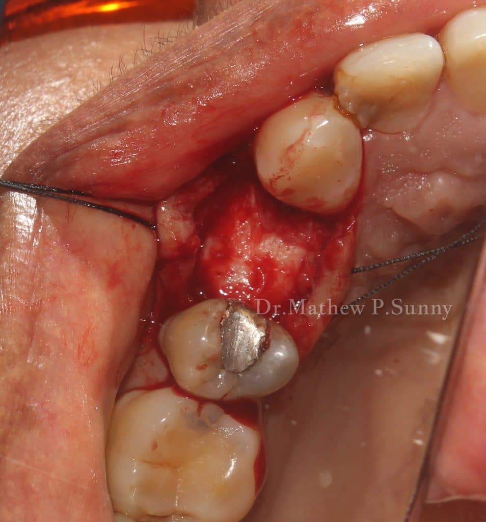 1000004666-wm-129900.19999998808_watermarked