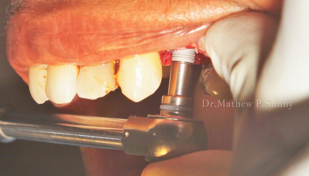 1000004668-wm-131014.19999998808_watermarked