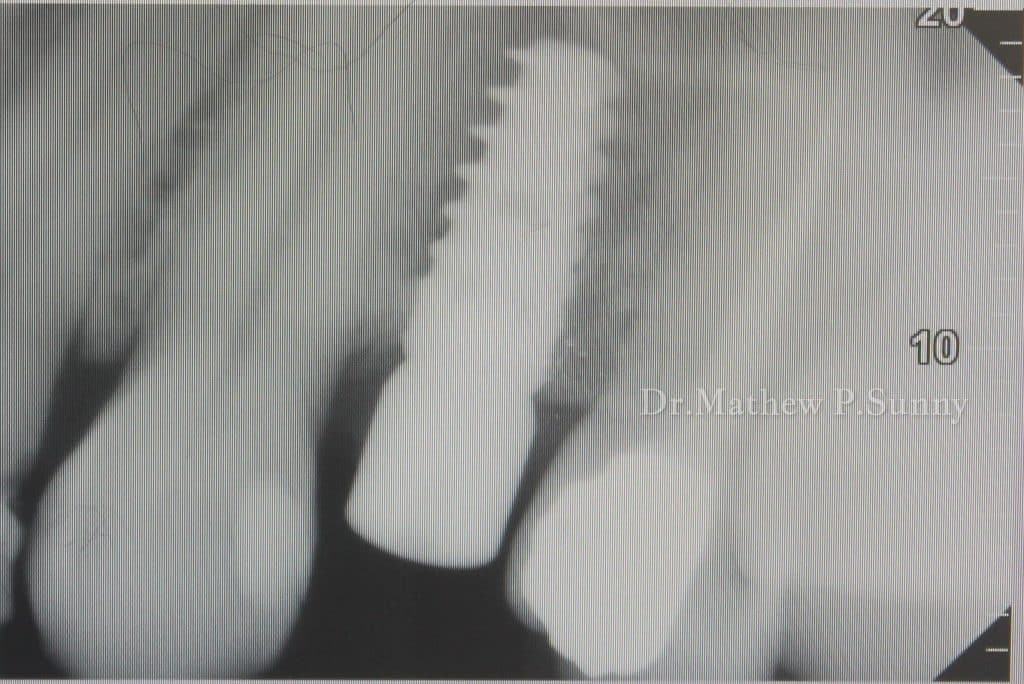 1000004671-wm-132789.29999998212_watermarked