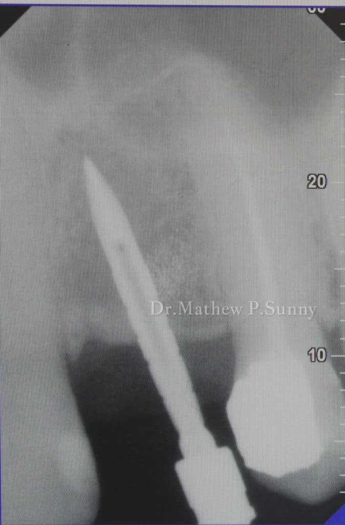 1000004672-wm-133826.5_watermarked