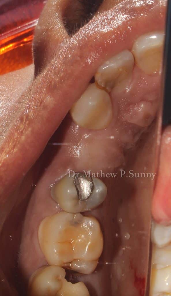 1000004673-wm-136274.79999998212_watermarked