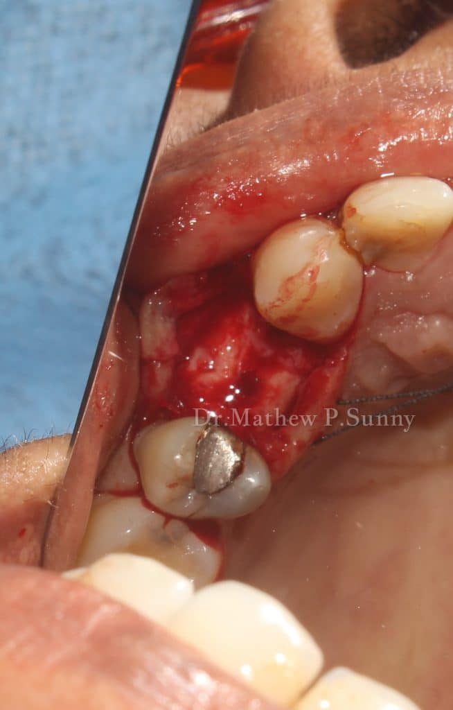 1000004674-wm-135058.90000000596_watermarked