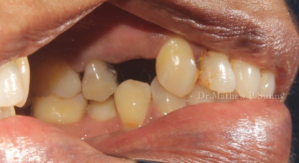 1000004675-wm-135694.19999998808_watermarked