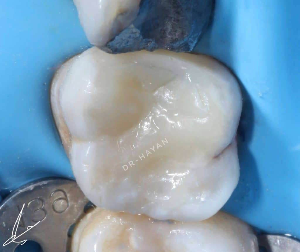 154EA314-38A6-46FC-8E0B-BB23953D9E99