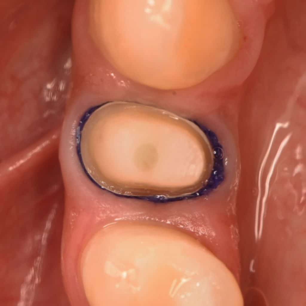 1734EA4C-9230-4ED5-B422-4CFF40E13837