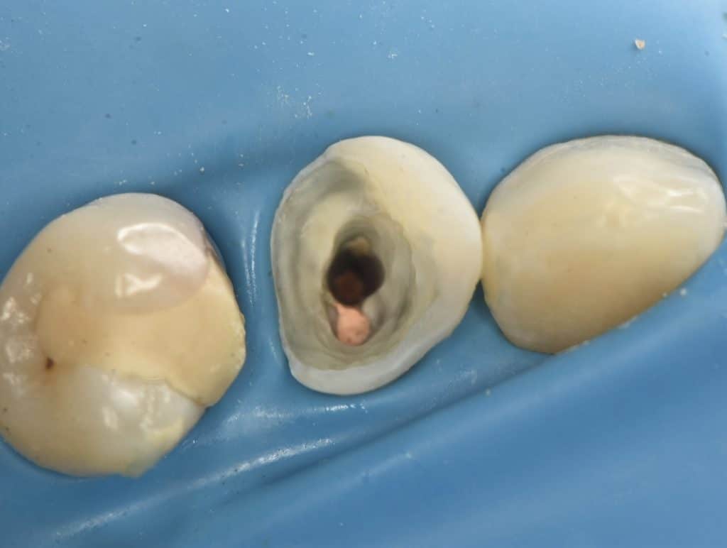 1CAB0F35-5B38-4730-887C-142F56F9995B