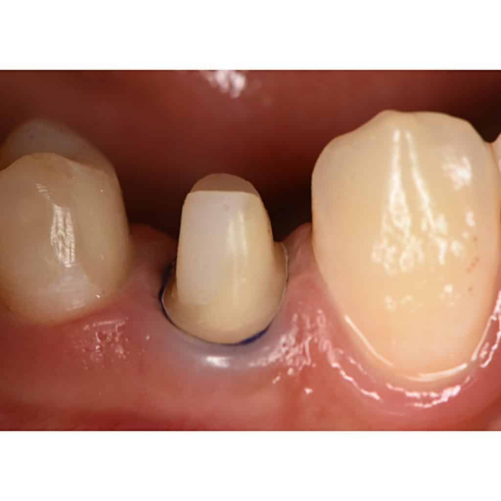 1EC5C321-5CAF-4F4B-8FFC-1669A1541343