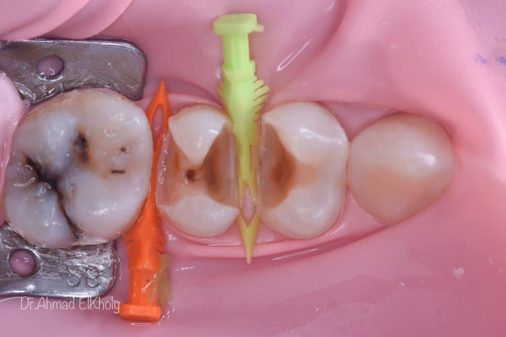 1F1D976B-A6B0-4A3A-8EED-0338099EAF31