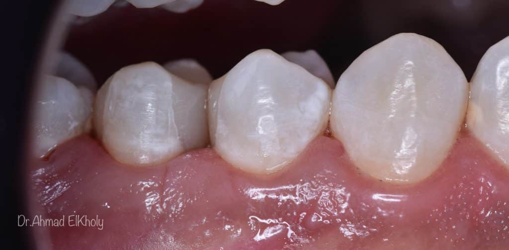 1F5D6AB0-67F0-4B79-8FF1-1F89FE35F99D