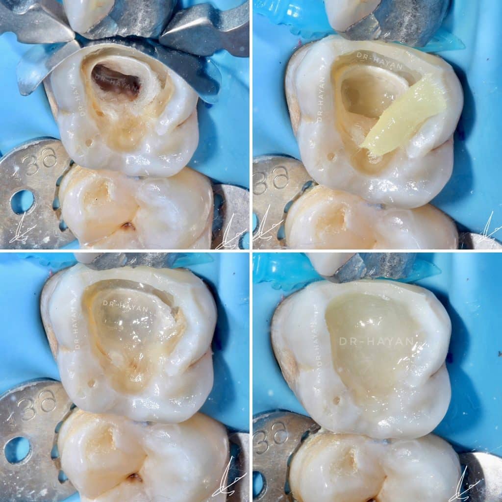 205D56B3-AF55-4F30-9996-B6813CC777C3