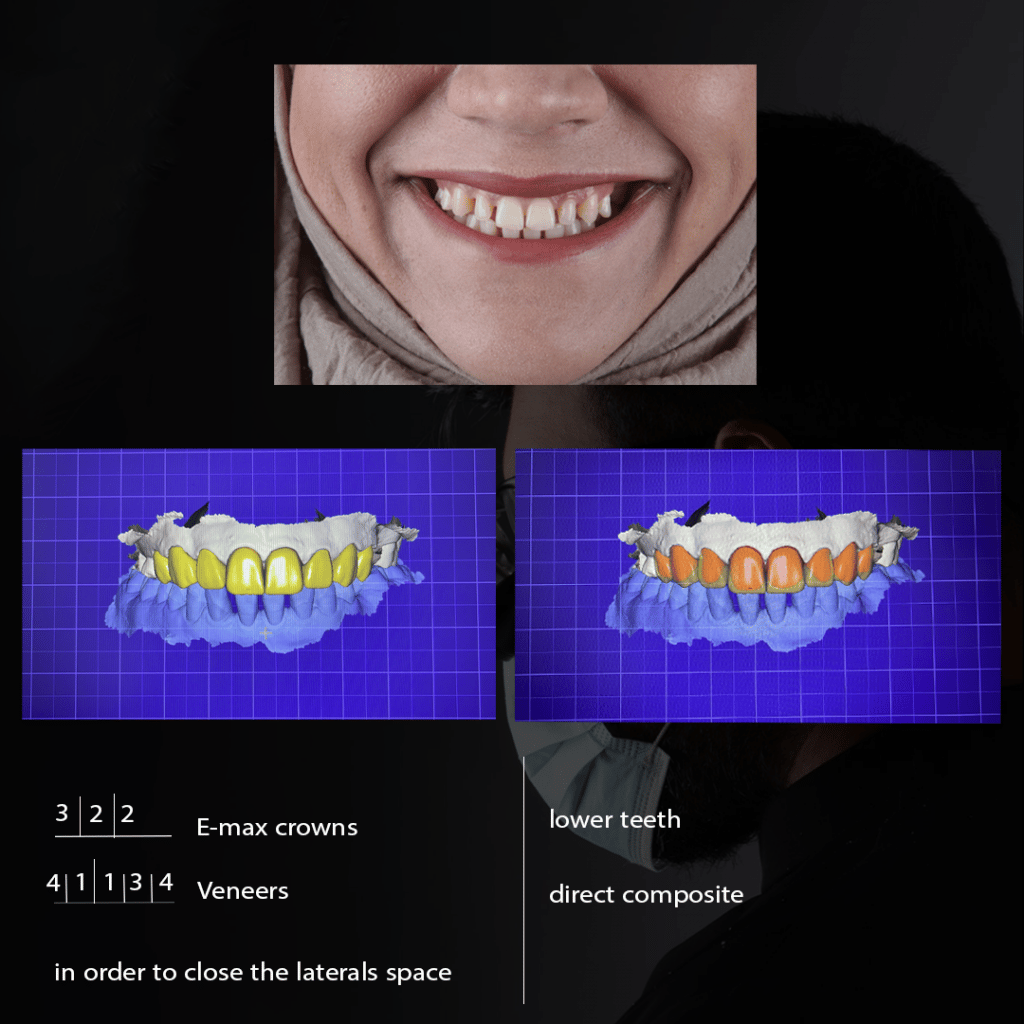 32E3FFF8-BC42-435E-AEDF-204E04A453B3